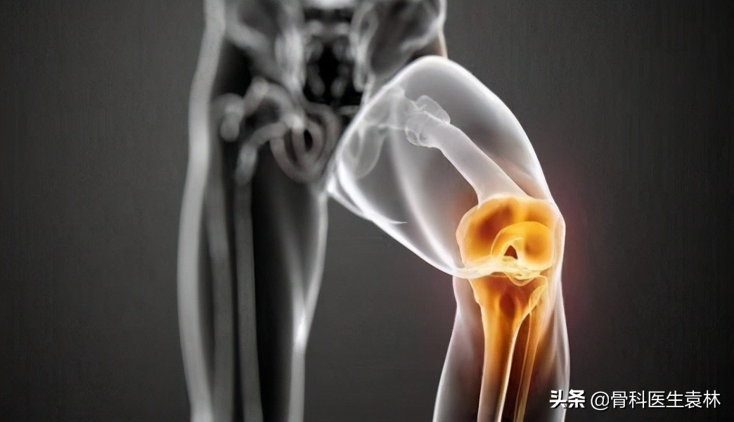 一侧胯骨疼 膝盖疼 腿有涨感_太阳晒得膝盖疼_60岁老人膝盖疼下面疼