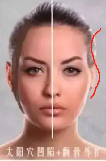 眉毛的骨头凸起面相分析_眉毛骨头凸起面相女人_眉毛骨头突出命运如何