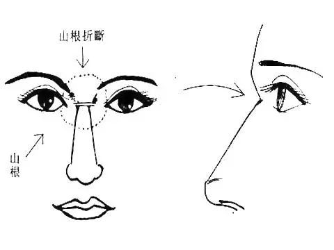 面相鼻子类型图片女_面相鼻子类型图片介绍_面相鼻子的类型及图片
