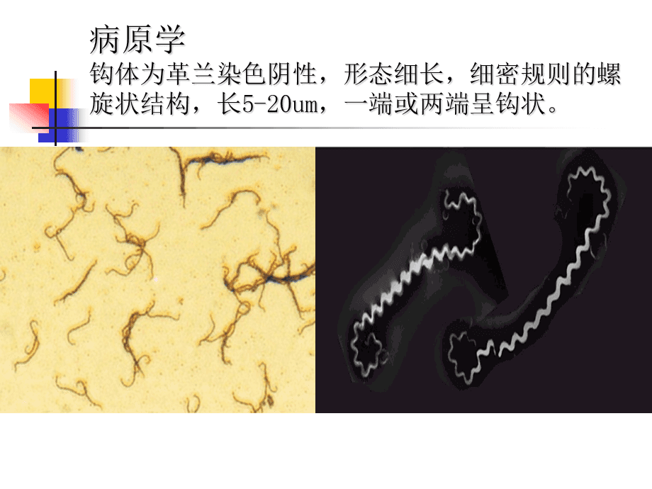 奋森氏螺旋体形态图片