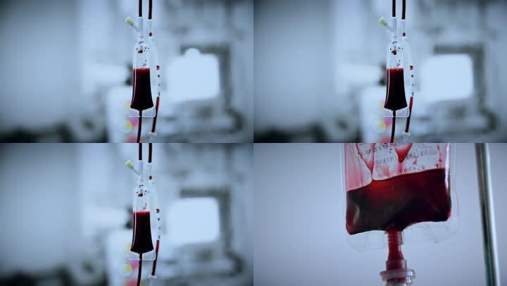 熊猫血是阴性血吗_hr阴性熊猫血属于哪种血型_熊猫血阴性是什么血型