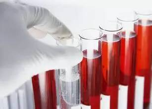 过敏的血型_过敏跟血型有关系吗_什么血型容易过敏